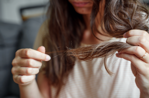 Hair Today, Gone Tomorrow: Nutrition & Hair Loss